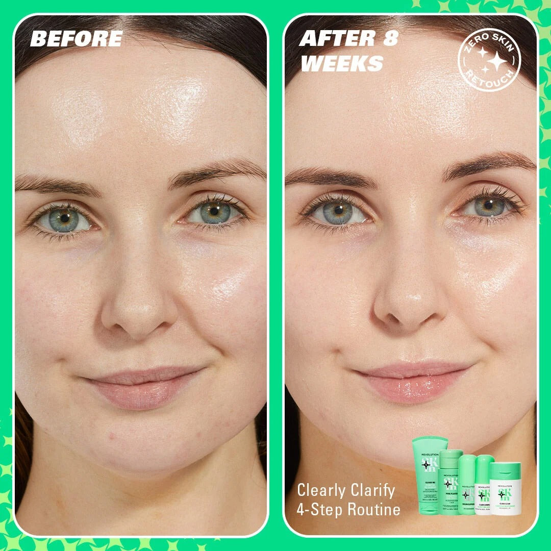 REVOLUTION SKIN CLEARLY CLARIFY 4 STEP STARTER KIT