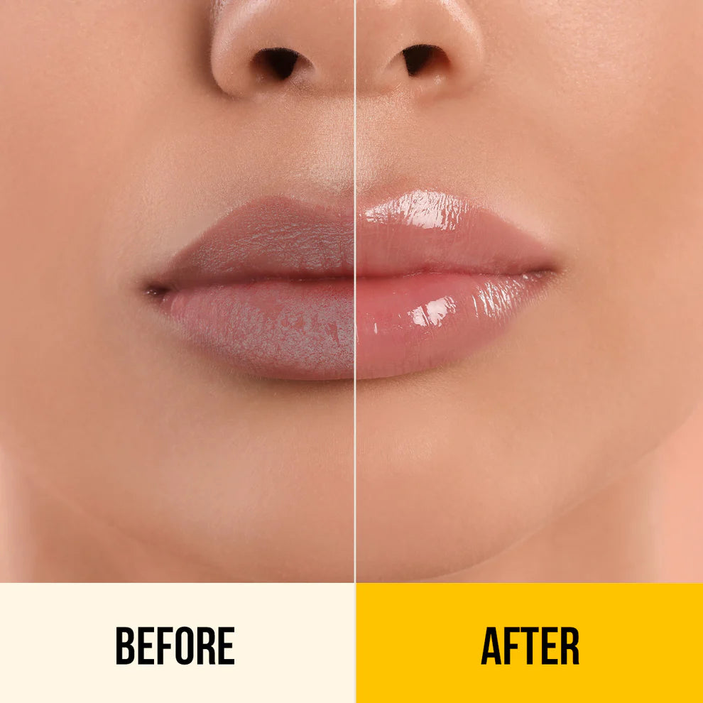 KESAR & KOJIC ACID LIP BALM 10G