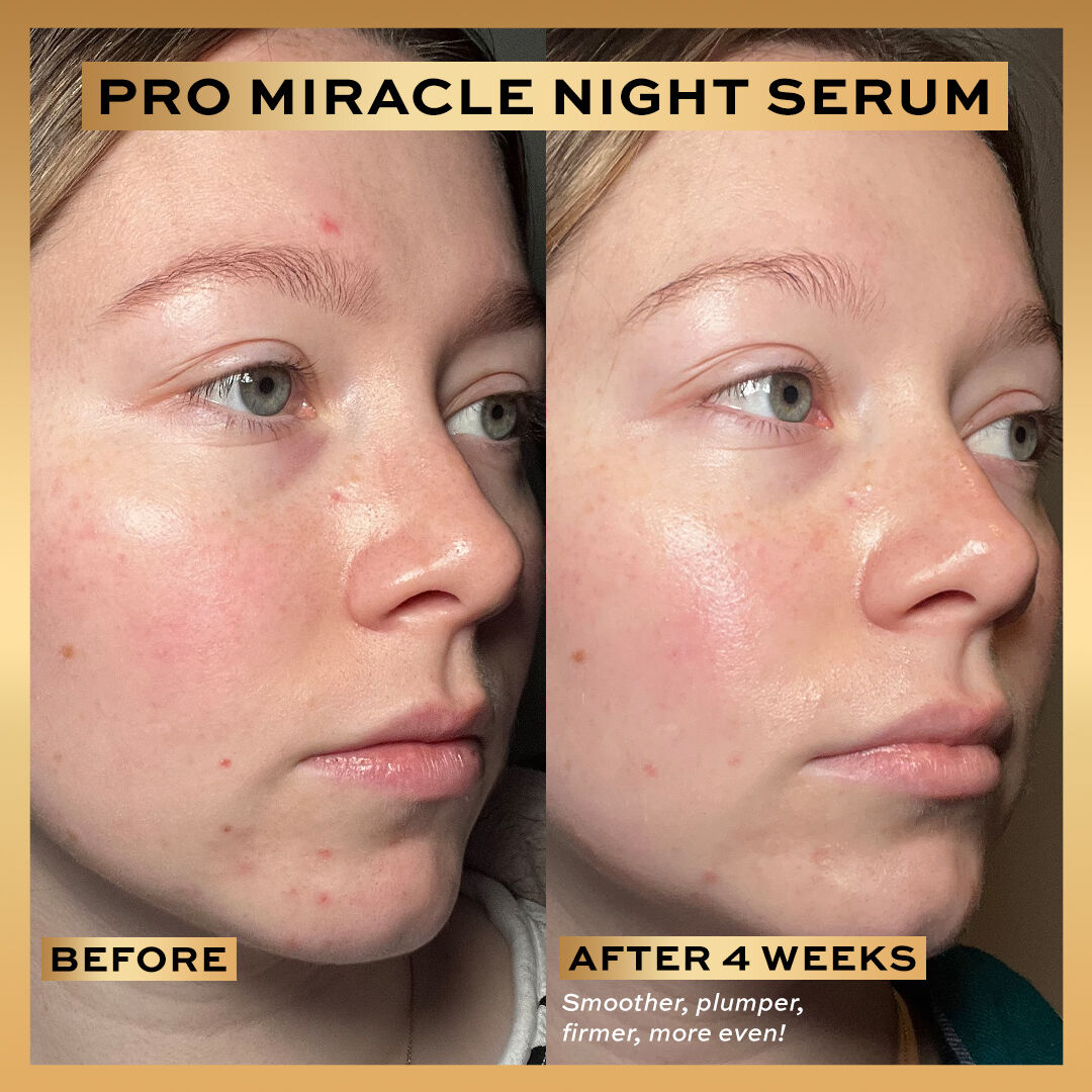 REVOLUTION PRO MIRACLE NIGHT RESCUE SERUM ADVANCED COMPLEX