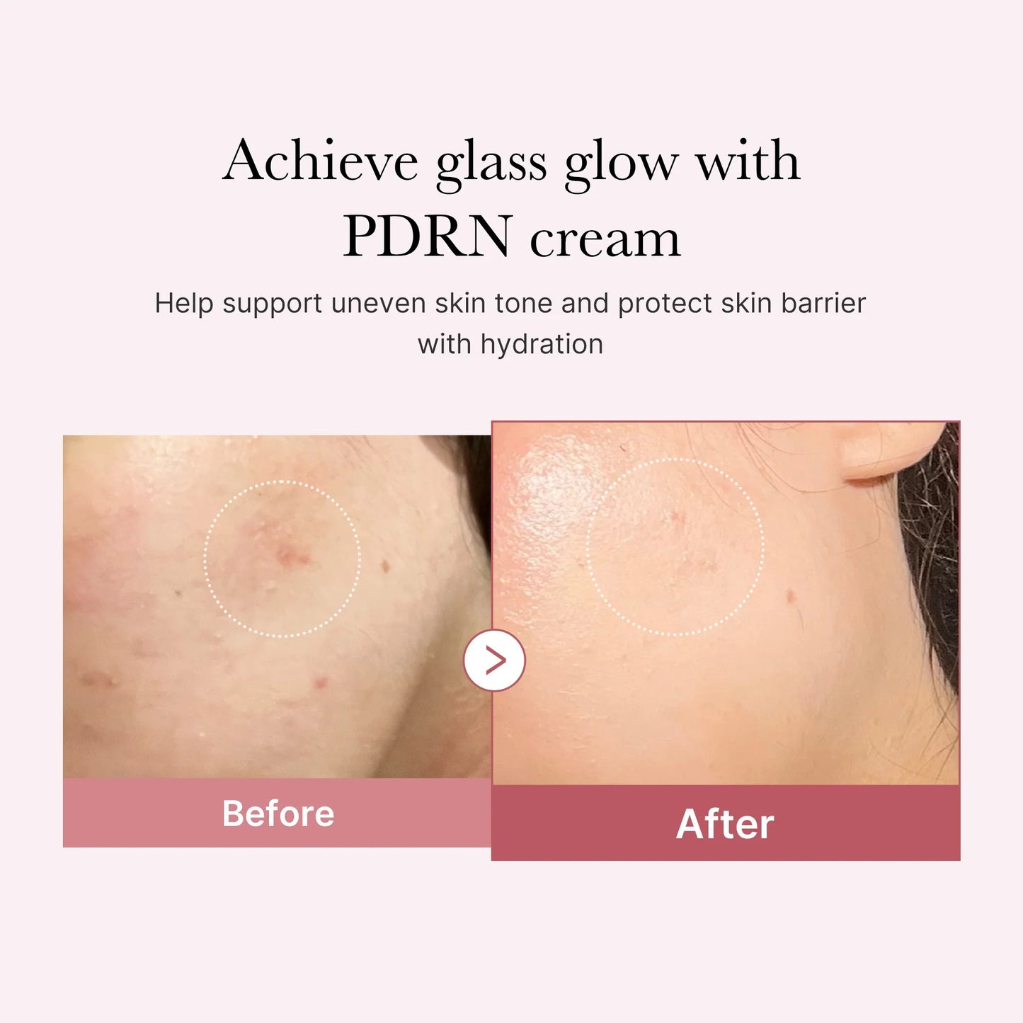 PDRN PINK HYALURONIC MOISTURIZING CREAM 50ML