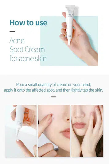 ACNE SPOT CREAM
