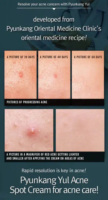 ACNE SPOT CREAM