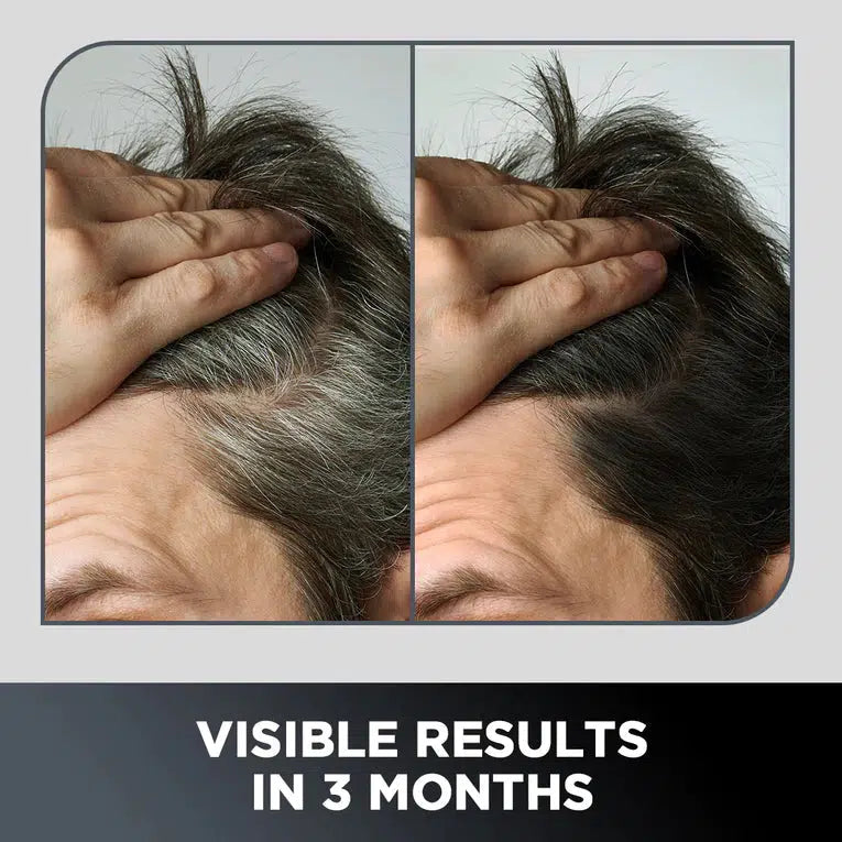 ANTI-GRAYING HAIR SHAMPOO + CONDITIONER