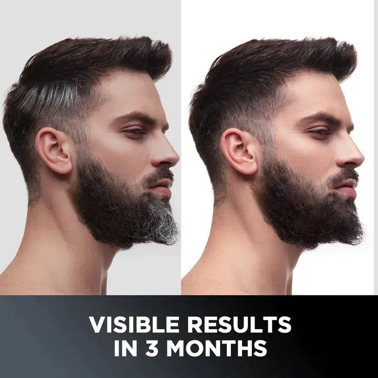 ANTI-GRAYING SERUM