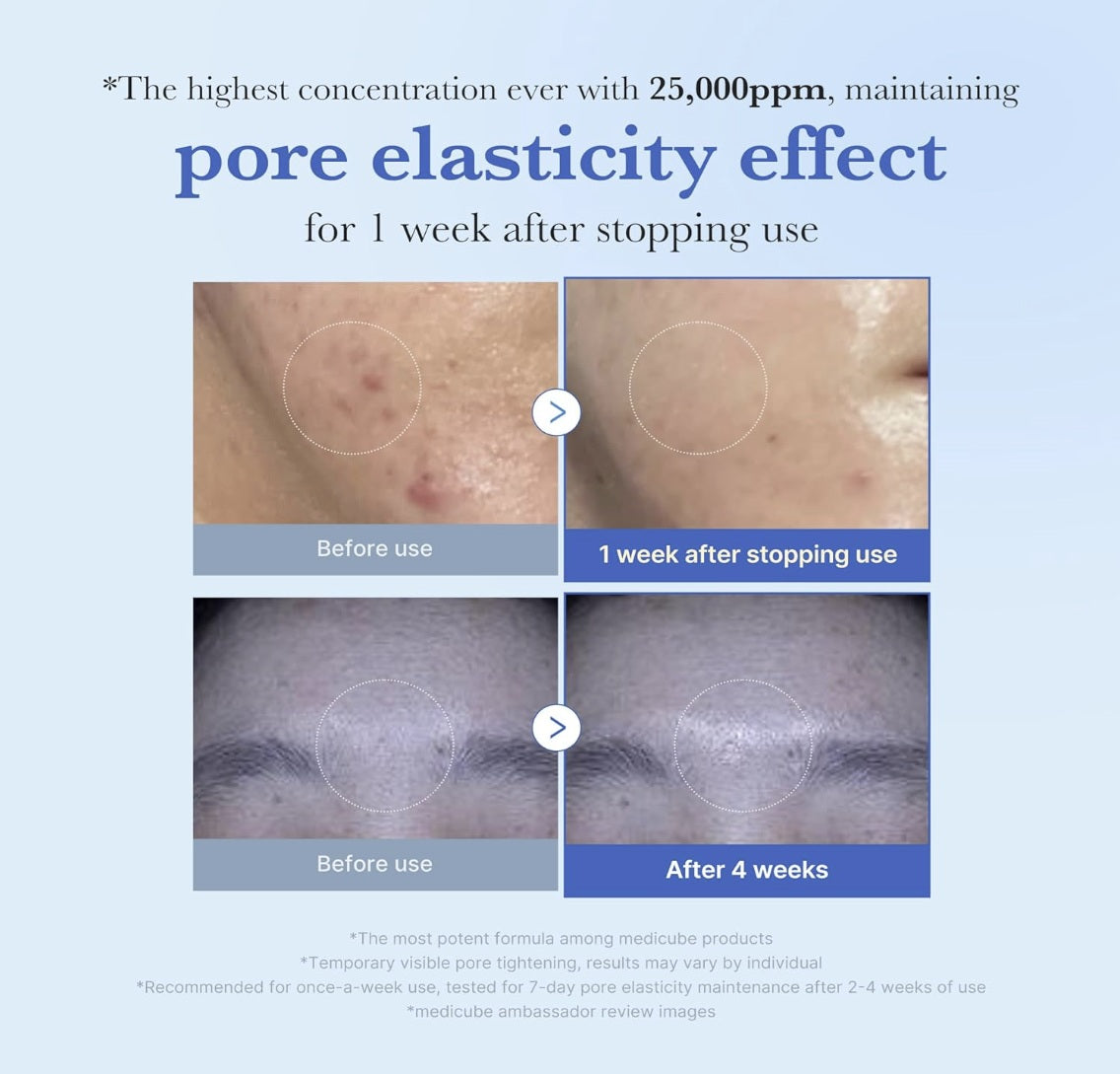 ONE DAY EXOSOME SHOT PORE AMPOULE 25000 13ML