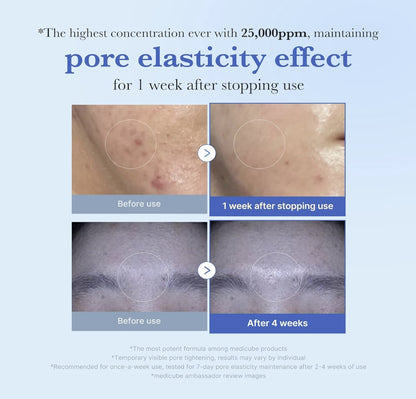 ONE DAY EXOSOME SHOT PORE AMPOULE 25000 13ML