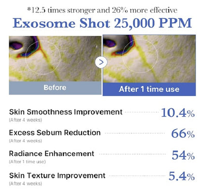 ONE DAY EXOSOME SHOT PORE AMPOULE 25000 13ML