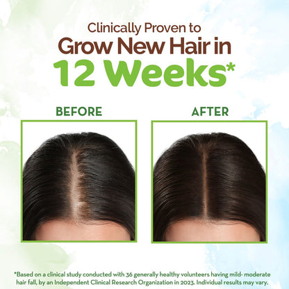 ROSEMARY HAIR GROWTH OIL FOR PROMOTING HAIR GROWTH 200ML