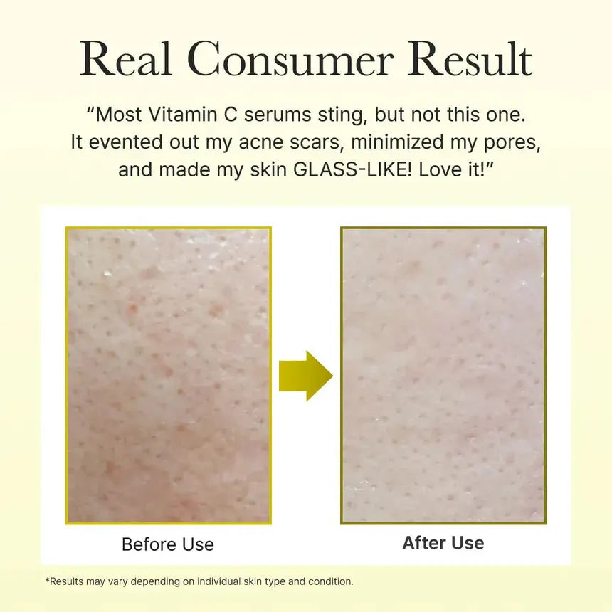 ARENCIA 10ml Vitamin C Booster Shot Serum — photo 2