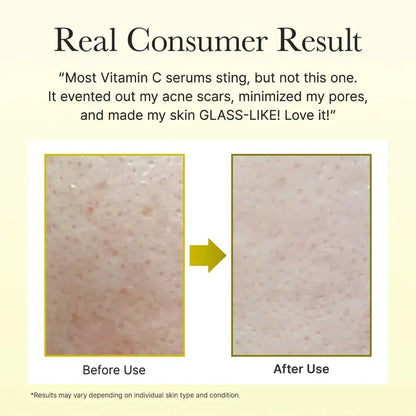 ARENCIA 10ml Vitamin C Booster Shot Serum — photo 2