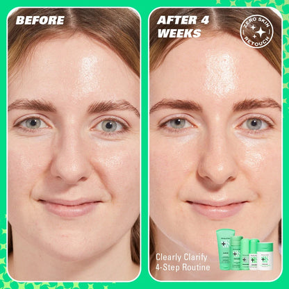 REVOLUTION SKIN SERUM SUPREME 10% NIACINAMIDE CLARIFYING SERUM