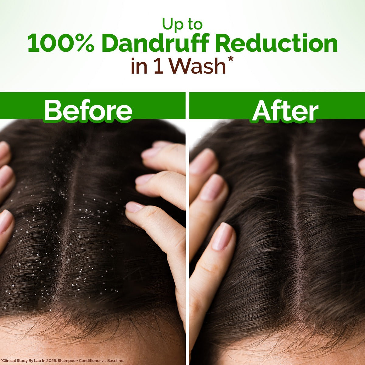 LEMON ANTI-DANDRUFF SHAMPOO 250 ML