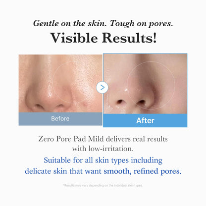 ZERO PORE TONER PAD MILD (70EA)155G
