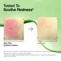MINI AZELAIC ACID 10 HYALURON REDNESS SOOTHING SERUM 10ML