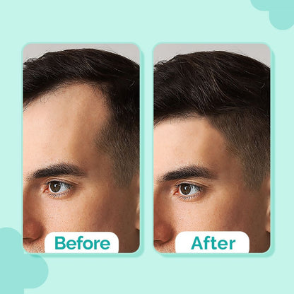 20% ACTIVES PEPTIDE-STEM CELL HAIR GROWTH SERUM