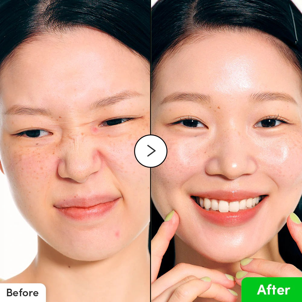 ALOE PDRN CALMING SERUM 30ML