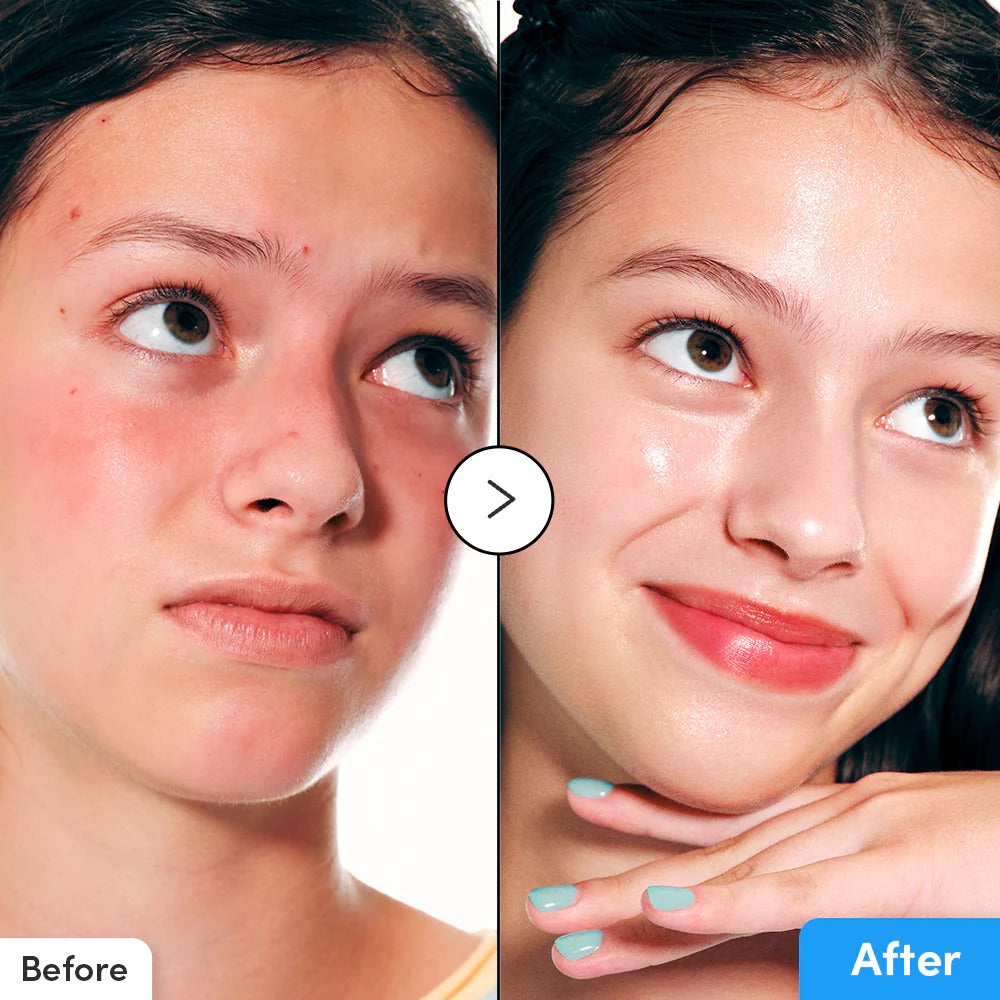 HYALTOIN FLOODING SERUM 30ML