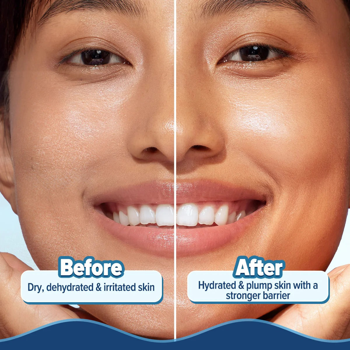 BARRIER+ HYDRA GEL MOISTURIZER 200G