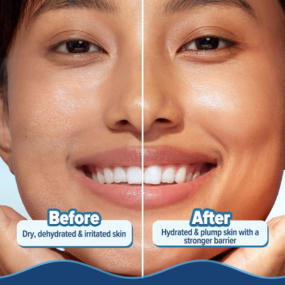 BARRIER+ HYDRA GEL MOISTURIZER 200G